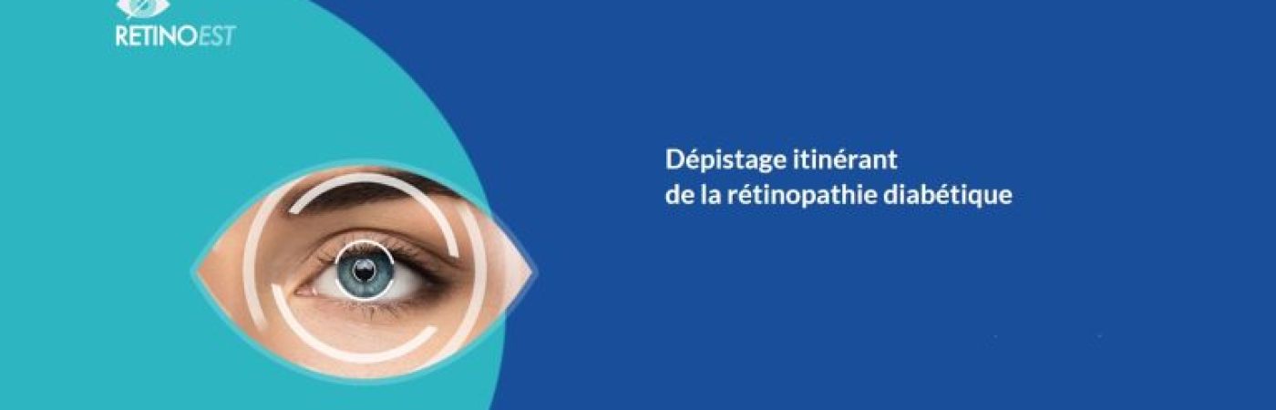 rétinoest image